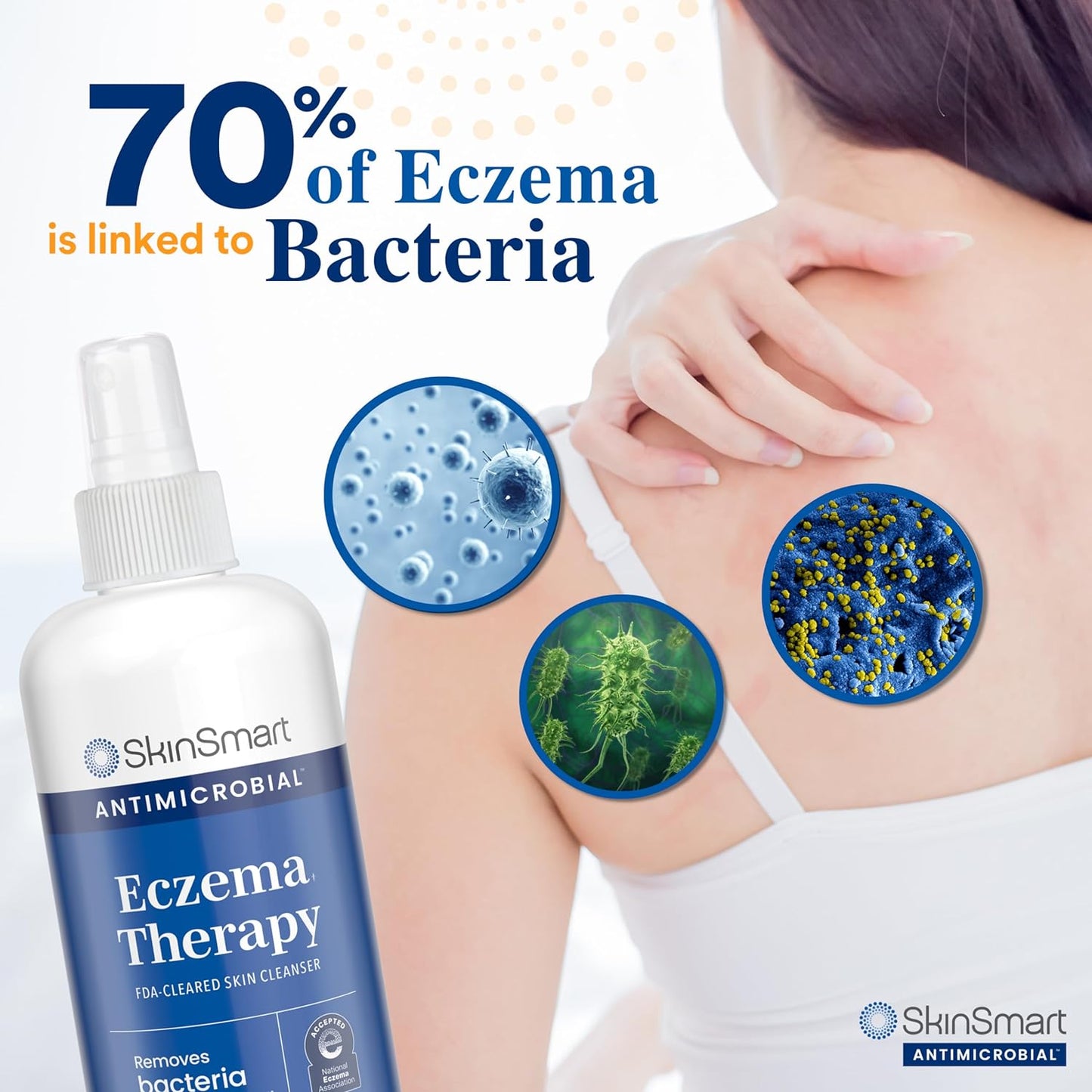 SkinSmart™ Antimicrobial Eczema Therapy Spray ( BUY 1 GET 1 FREE )