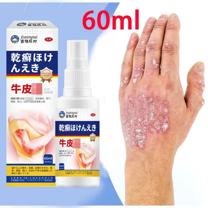 Imported japan Psoriasis Anti - Itch Spray