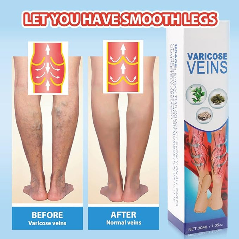 💜 South Moon VeinHealing™ Varicose Veins Spray🌿💦