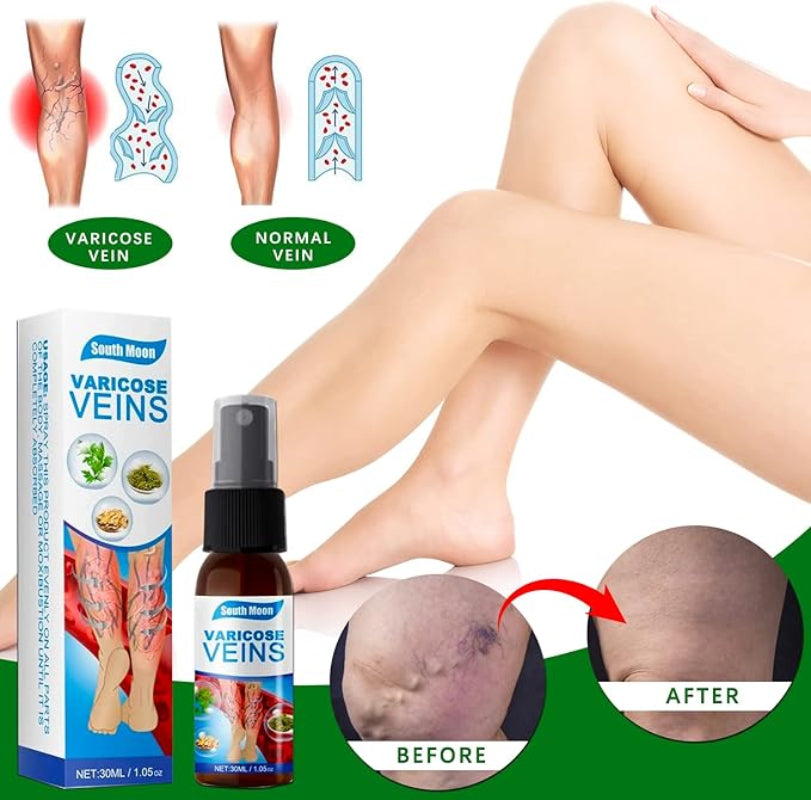 💜 South Moon VeinHealing™ Varicose Veins Spray🌿💦