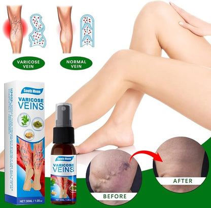 💜 South Moon VeinHealing™ Varicose Veins Spray🌿💦