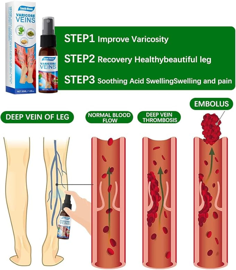💜 South Moon VeinHealing™ Varicose Veins Spray🌿💦