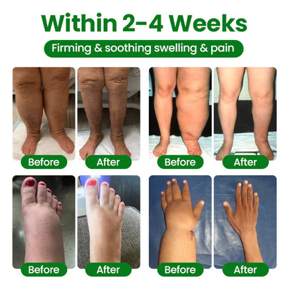 Timilk® VeinFlex Magnesium Relief Spray