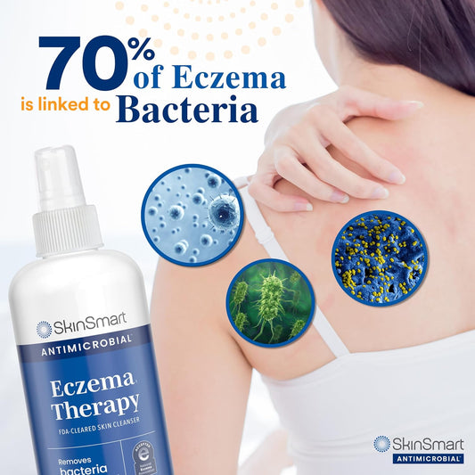 SkinSmart™ Antimicrobial Eczema Therapy Spray ( BUY 1 GET 1 FREE )