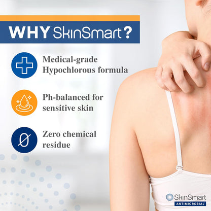 SkinSmart™ Antimicrobial Eczema Therapy Spray ( BUY 1 GET 1 FREE )