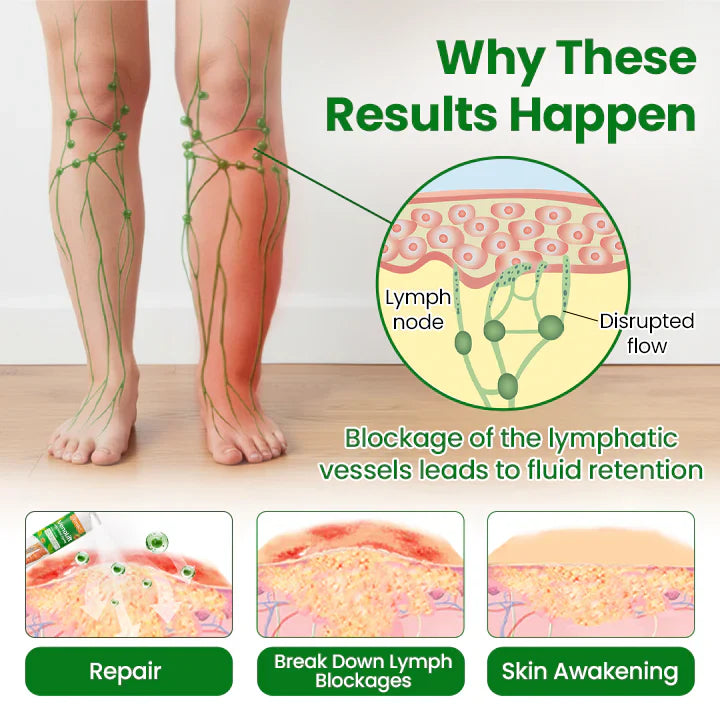 Timilk® VeinFlex Magnesium Relief Spray