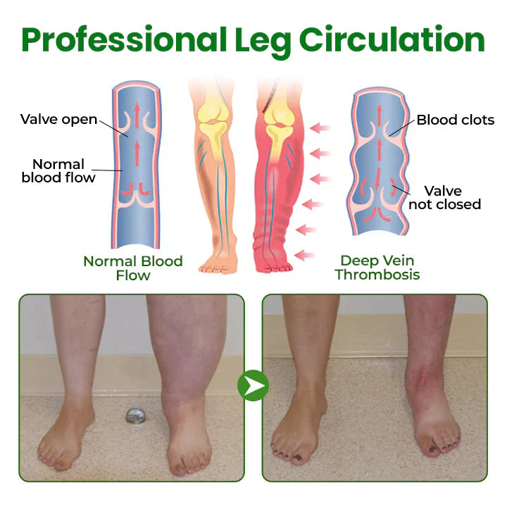 Timilk® VeinFlex Magnesium Relief Spray