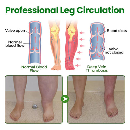 Timilk® VeinFlex Magnesium Relief Spray