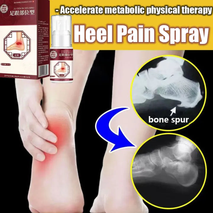 Plantar Fasciitis Heel Pain Spray (BUY 1 GET 1 FREE)