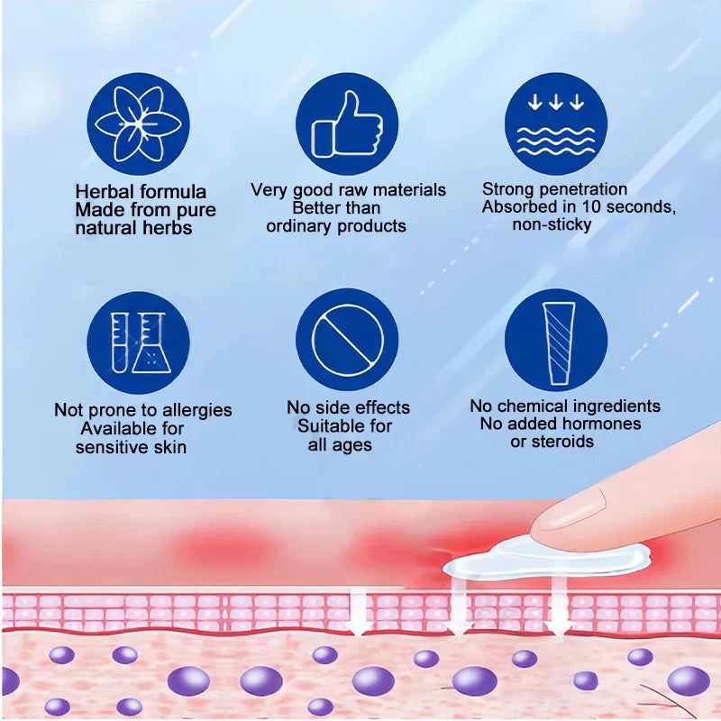 Imported japan Psoriasis Anti - Itch Spray