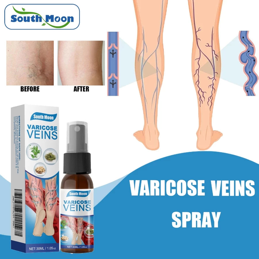 💜 South Moon VeinHealing™ Varicose Veins Spray🌿💦