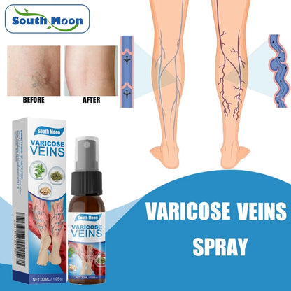 💜 South Moon VeinHealing™ Varicose Veins Spray🌿💦