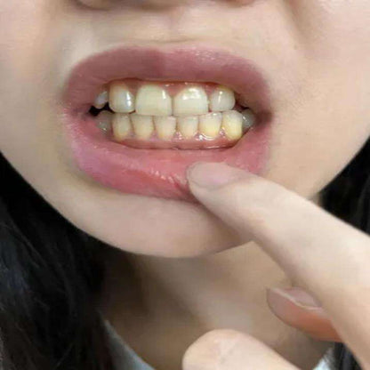 Dr.ville Niacinamide Toothpaste Removal Yellow Stains ( BUY 1 GET 1 FREE )