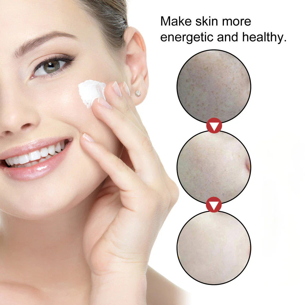 🌺🌙 GlowFade Radiance Repair Cream – Freckle, Pigmentation & Acne Scar Solution 🌸💧