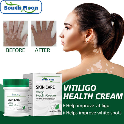 Herbal Vitiligo White Spot Remove Cream ( BUY 1 GET 1 FREE )