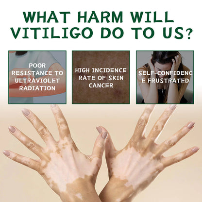 Herbal Vitiligo White Spot Remove Cream ( BUY 1 GET 1 FREE )