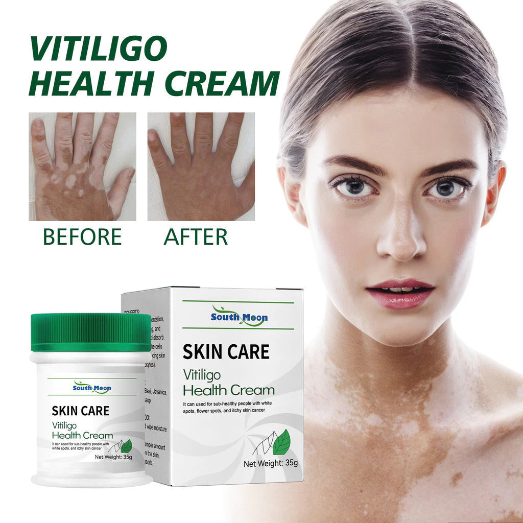 Herbal Vitiligo White Spot Remove Cream ( BUY 1 GET 1 FREE )