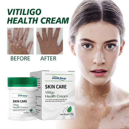Herbal Vitiligo White Spot Remove Cream ( BUY 1 GET 1 FREE )